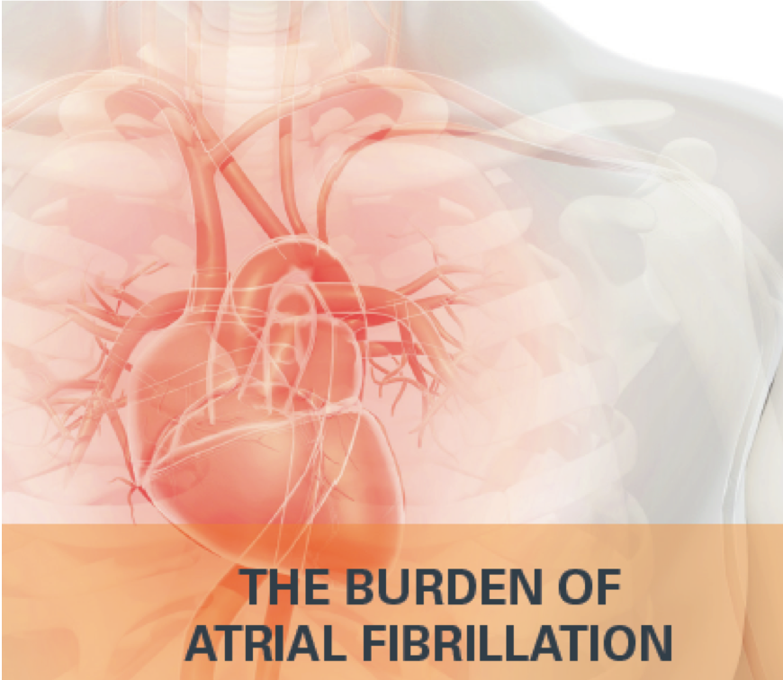 afib