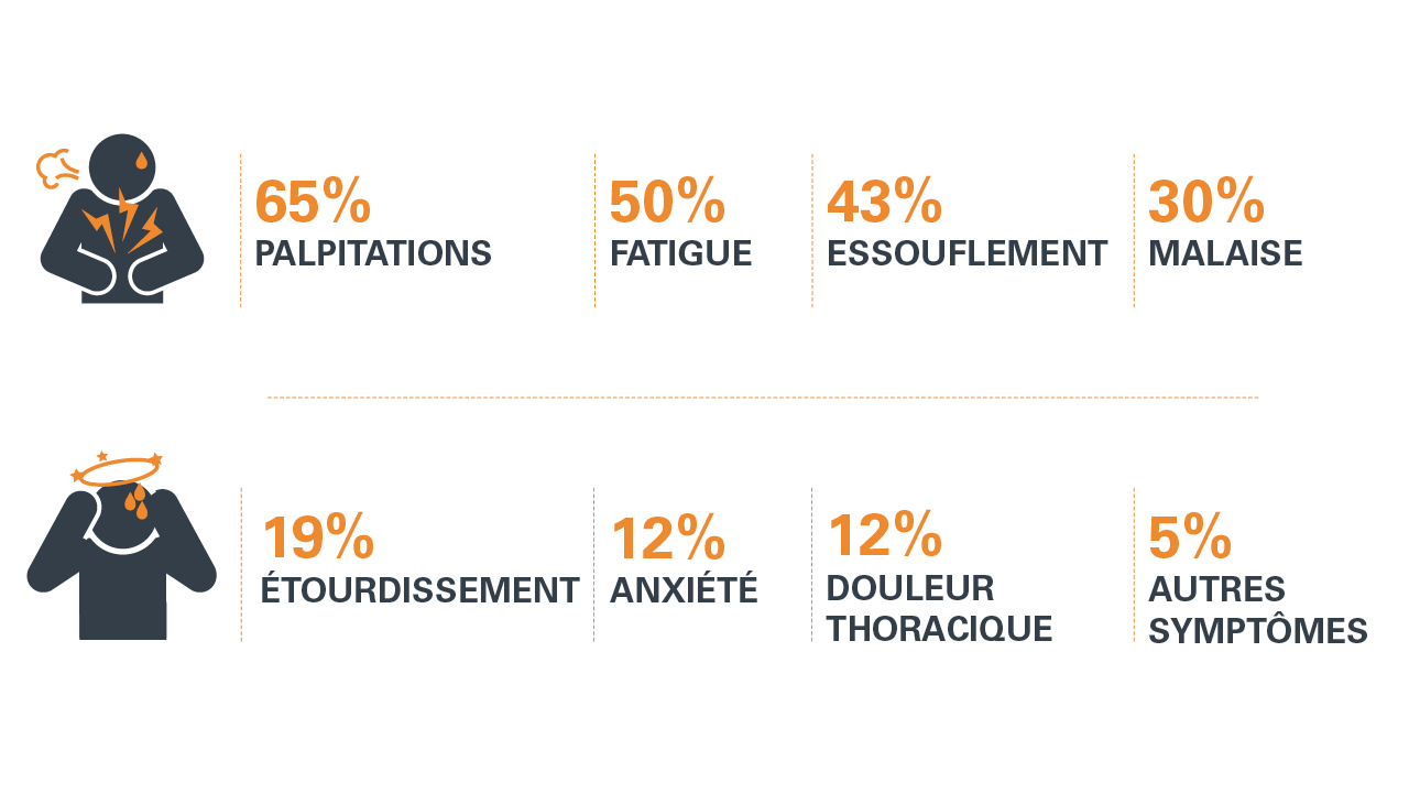 fibrillation atriale symptomes