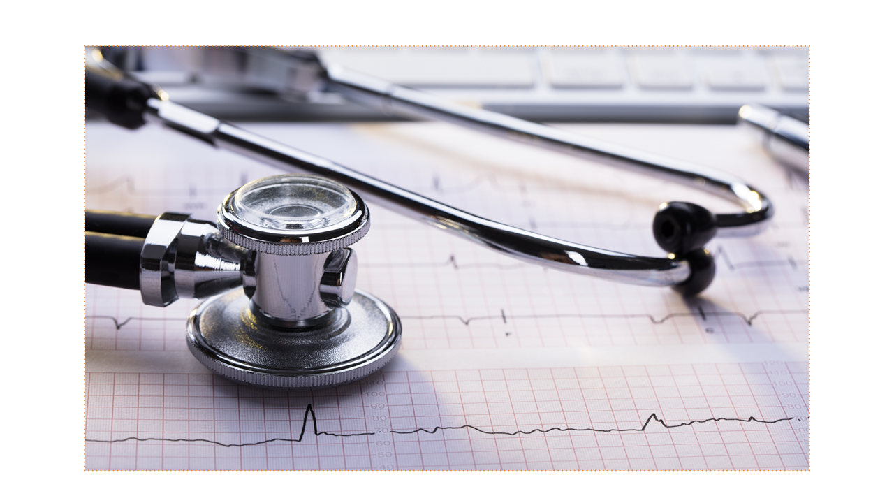 frequenza cardiaca FA