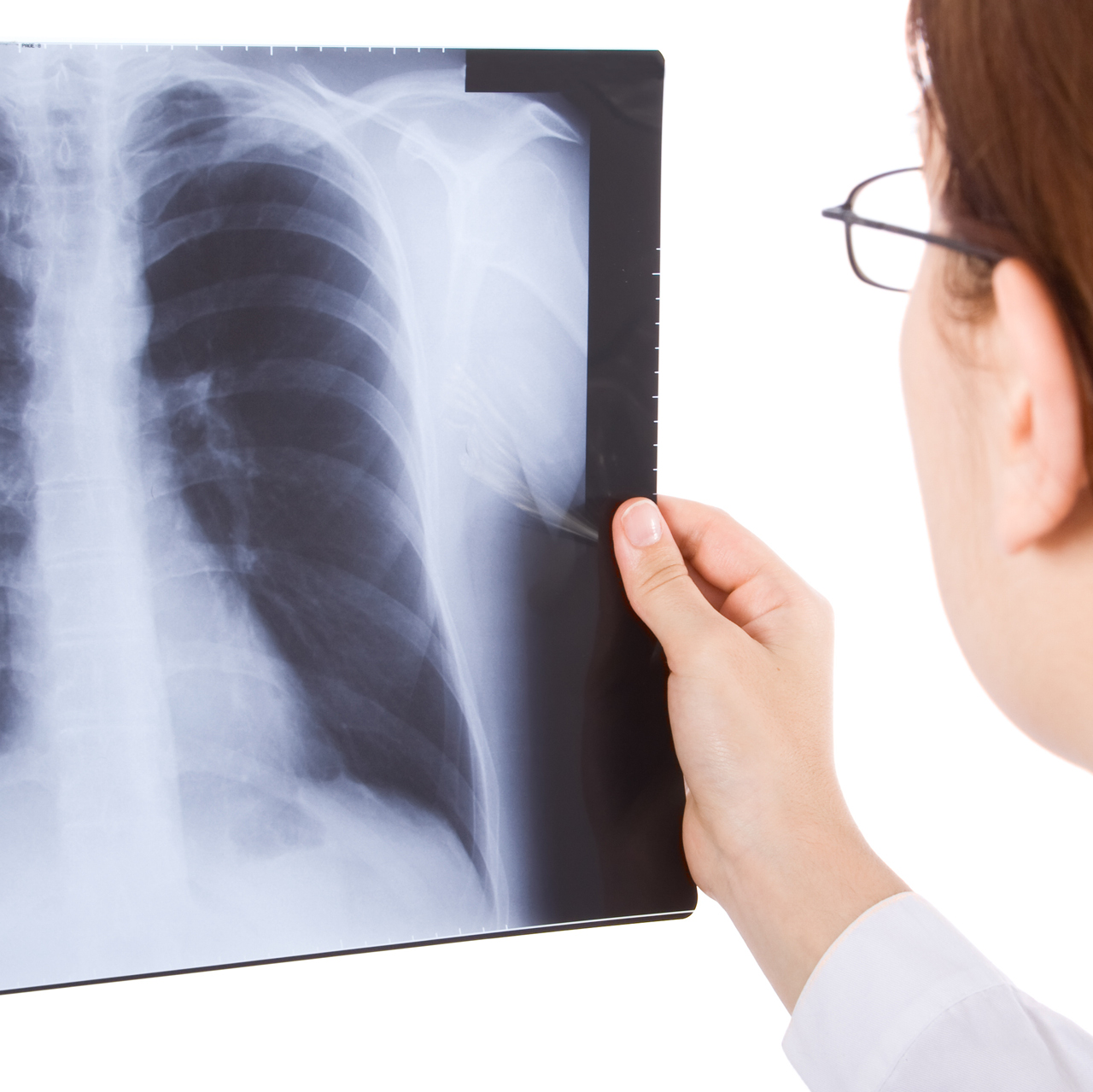 fa frequenza cardiaca