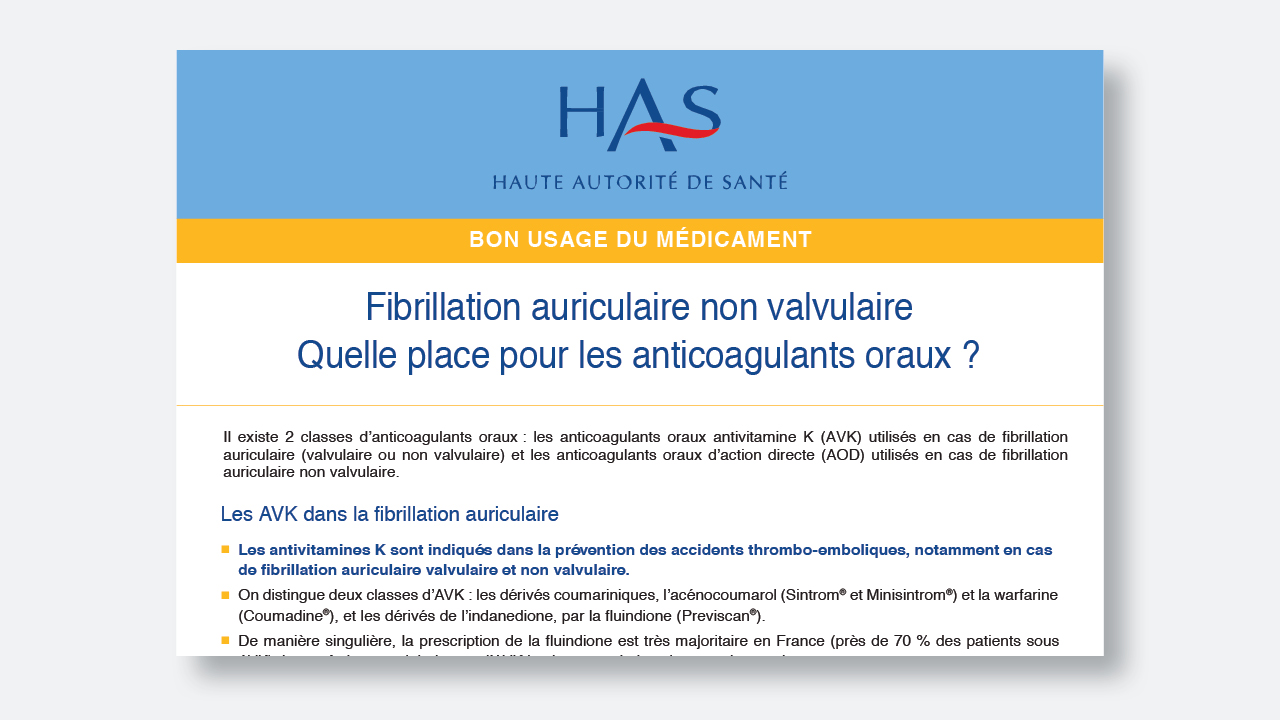 has fibrillation auriculaire