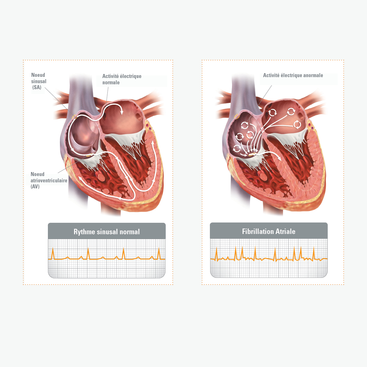 rythme cardiaque