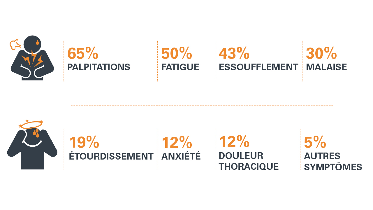 fibrillation atriale symptomes