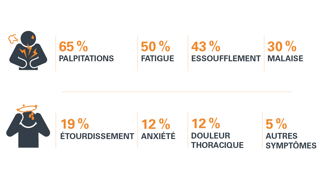 fibrillation atriale symptomes